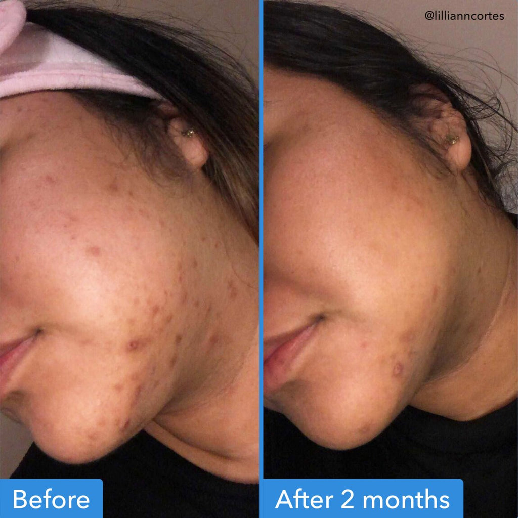 DISCOLORATION CORRECTING SERUM