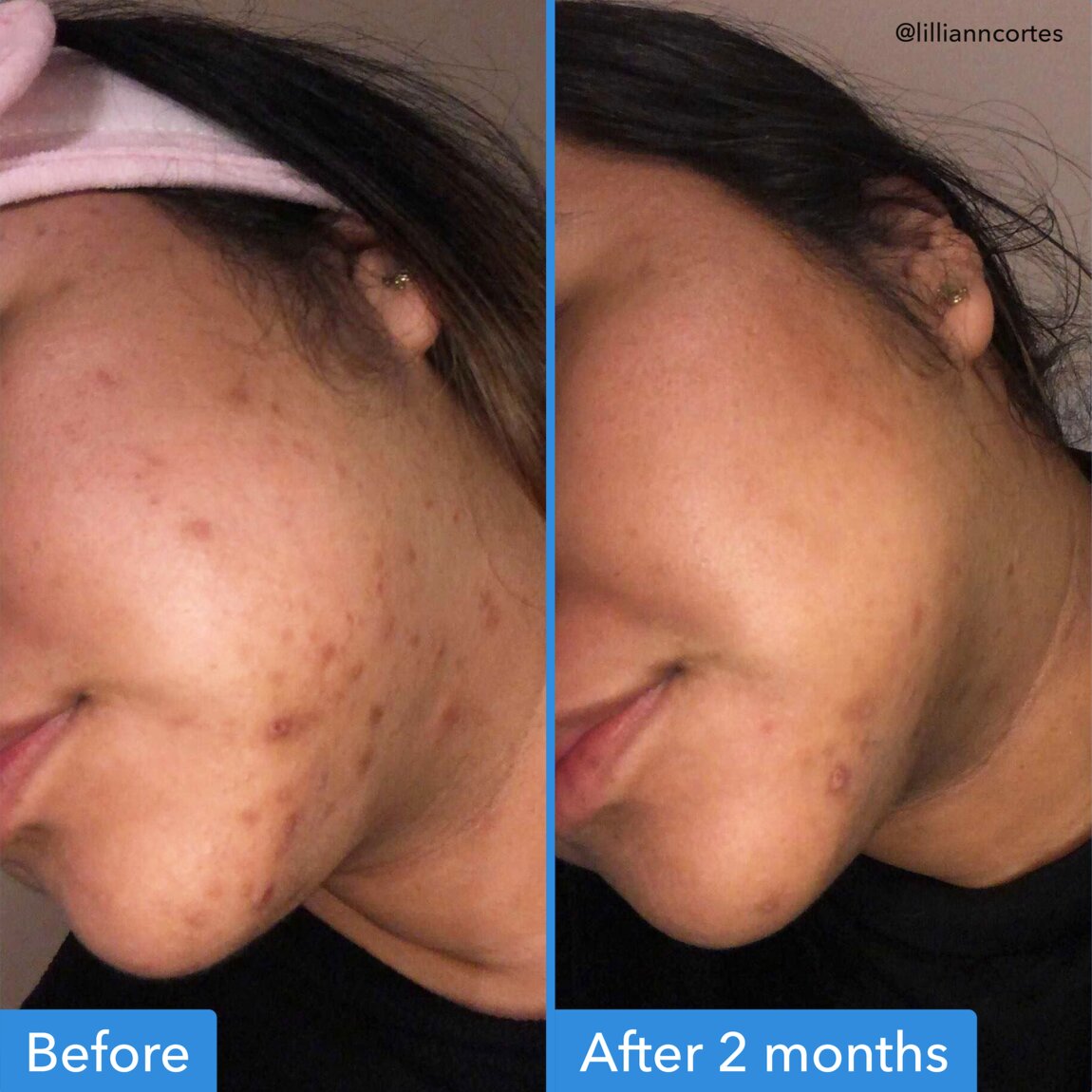 DISCOLORATION CORRECTING SERUM