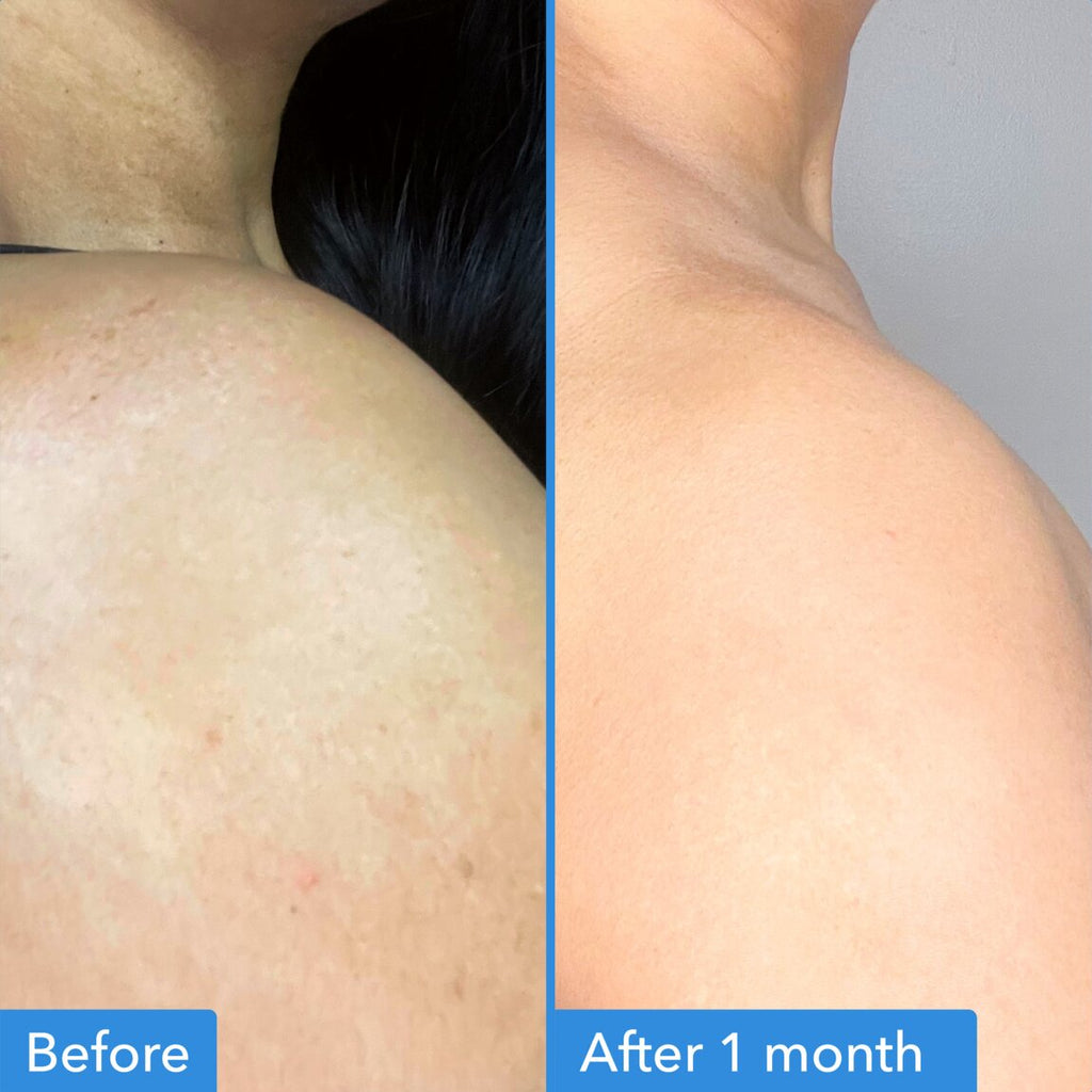 DISCOLORATION CORRECTING BODY TREATMENT