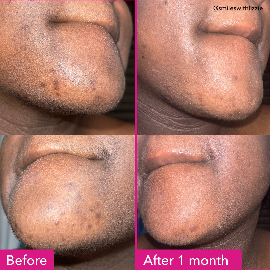 BRIGHTENING & DARK SPOTS BAR